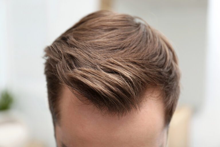 Kapsels voor mannen met inhammen: stijlvol en zelfverzekerd!