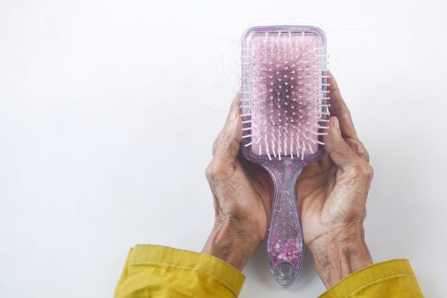 Kapsels voor vrouwen met veel haarverlies: wat te doen als je kaal wordt?
